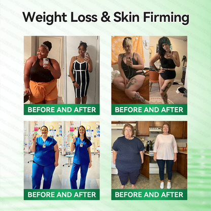 🆗🆗𝑶𝒇𝒇𝒊𝒄𝒊𝒂𝒍 𝑺𝒕𝒐𝒓𝒆 |𝐂𝐚𝐫𝐞𝐔𝐩𝐥𝐢𝐟𝐭® 𝑴𝒆𝒕𝒂𝒃𝒐𝒍𝒊𝒄 𝑵𝒂𝒏𝒐 𝑴𝒊𝒄𝒓𝒐𝒏𝒆𝒆𝒅𝒍𝒆 𝑷𝒂𝒕𝒄𝒉🇺🇸(𝐉𝐮𝐬𝐭 𝐨𝐧𝐜𝐞 𝐚 𝐝𝐚𝐲, 𝐯𝐢𝐬𝐢𝐛𝐥𝐞 𝐜𝐡𝐚𝐧𝐠𝐞𝐬 𝐢𝐧 𝟕 𝐝𝐚𝐲𝐬）𝘽𝙚𝙧𝙗𝙚𝙧𝙞𝙣𝙚 + 𝙈𝙤𝙧𝙞𝙣𝙜𝙖 𝙁𝙤𝙧𝙢𝙪𝙡𝙖 ✅ 𝐅𝐨𝐫 𝐨𝐛𝐞𝐬𝐢𝐭𝐲, 𝗟𝗼𝗼𝘀𝗲 𝘀𝗸𝗶𝗻,𝐝𝐢𝐚𝐛𝐞𝐭𝐞𝐬, 𝐬𝐥𝐞𝐞𝐩 𝐚𝐩𝐧𝐞𝐚, 𝐣𝐨𝐢𝐧𝐭 𝐢𝐬𝐬𝐮𝐞𝐬, 𝐚𝐧𝐝 𝐦𝐨𝐫𝐞 💯💯